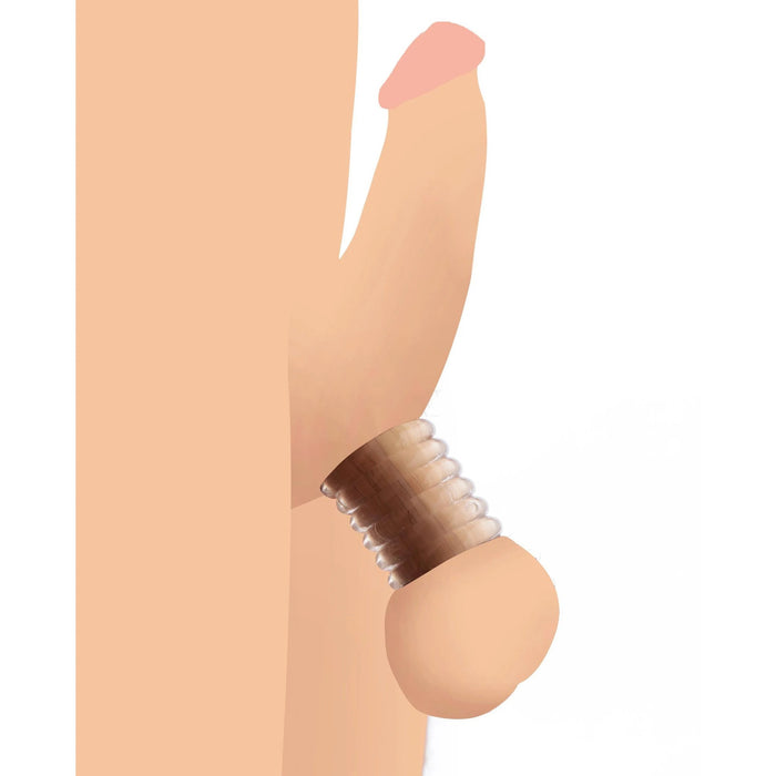 Illustration showing placement of Master Series Ring Master clear ball stretcher rings